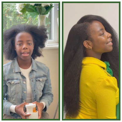 T444Z Hair Food For Scalp & Rapid Hair Growth