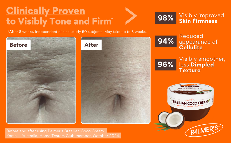 Palmer's Coconut Oil Formula Brazilian Coco Cream